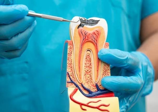 Root Canal Treatment in Greater Noida West