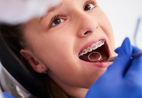 Affordable Dental Braces in Greater Noida West