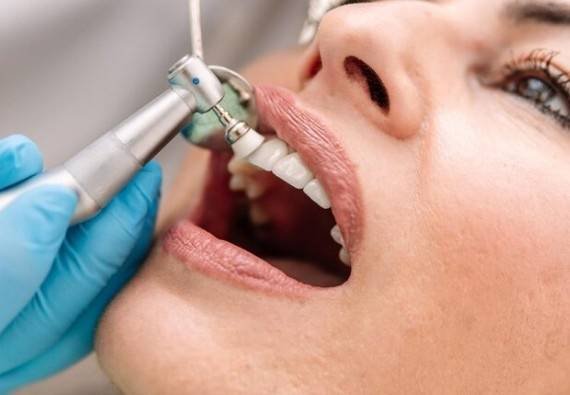 Teeth Polishing Clinic in Greater Noida West