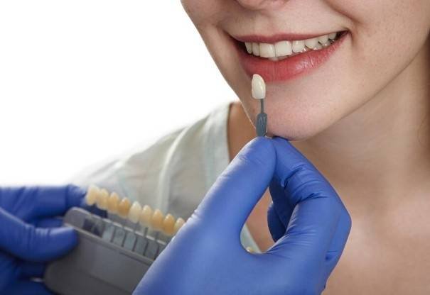 Dental Veneers Services in Greater Noida West