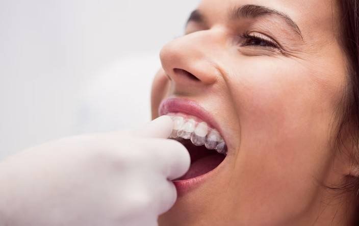 Clear Aligners in Greater Noida West