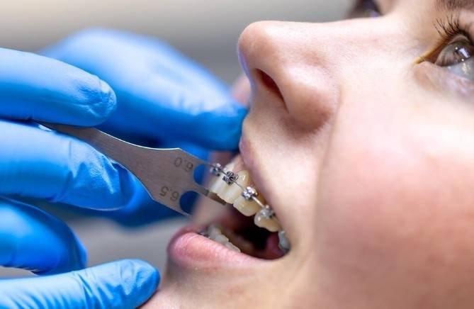 Orthodontist Care in Greater Noida West