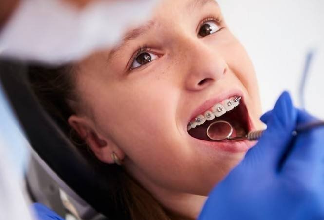 Dental Braces Specialist in Greater Noida West