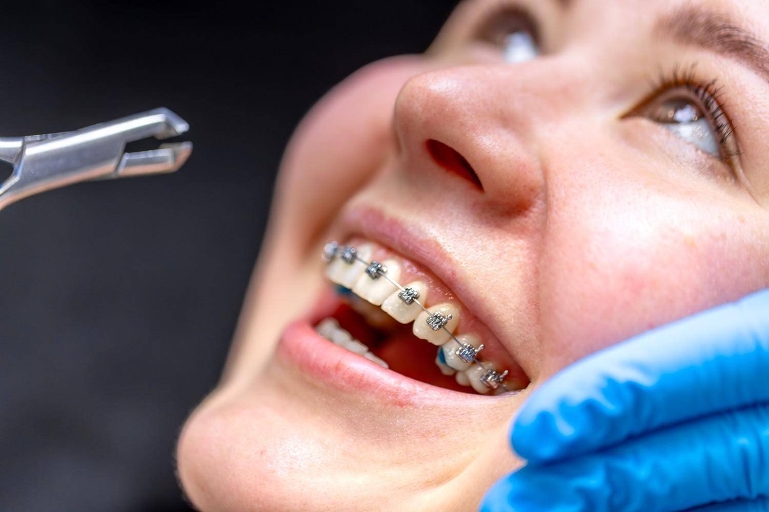 Affordable Orthodontics Treatment in Greater Noida West