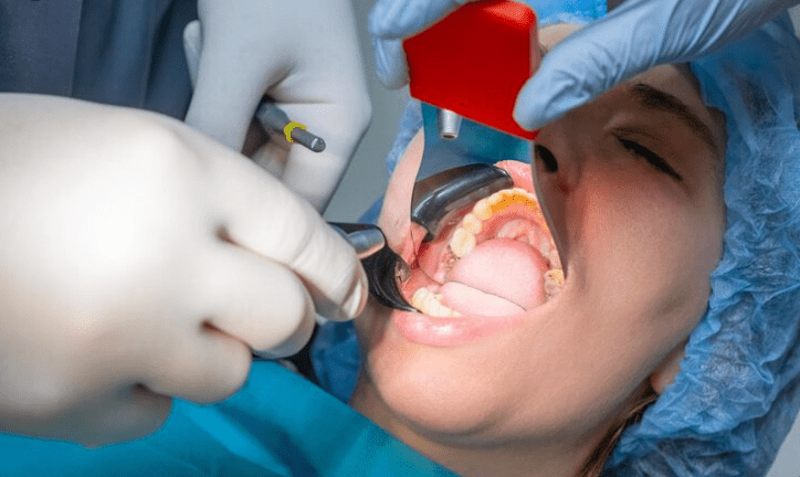 Cosmetic Periodontal Surgery in Gaur City 2