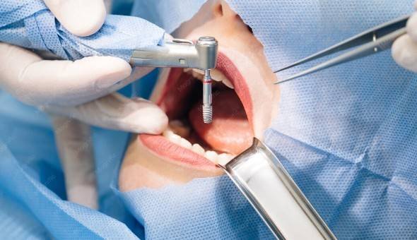 Affordable Osseous Surgery in Greater Noida
