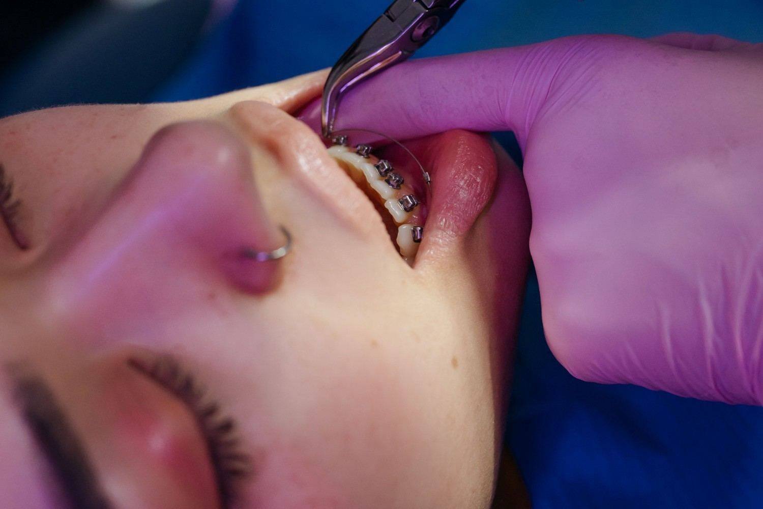 Orthodontic Clinic in Ghaziabad