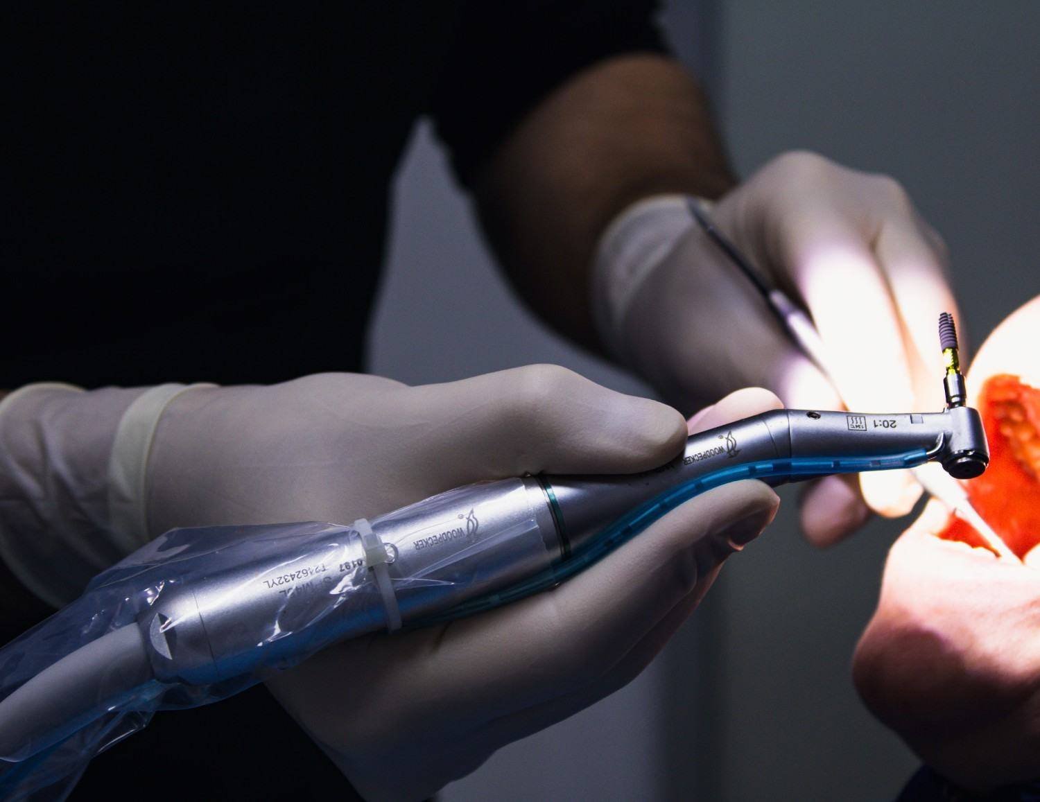 Osseous Surgery Treatment in Greater Noida West
