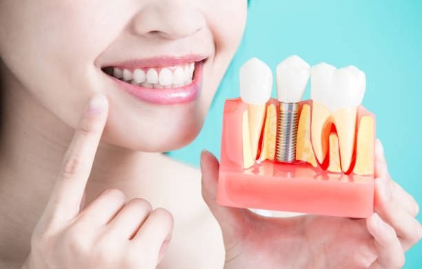 woman take tooth implant false tooth on green background